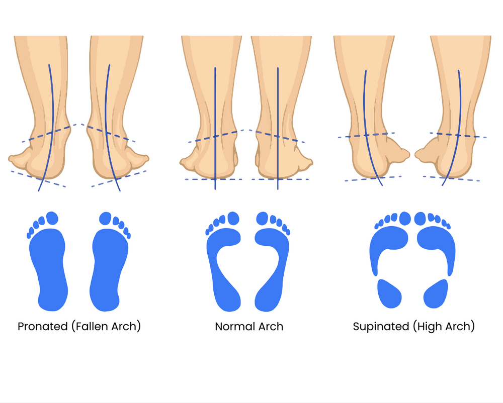 Learn | DrFootman Custom Feet